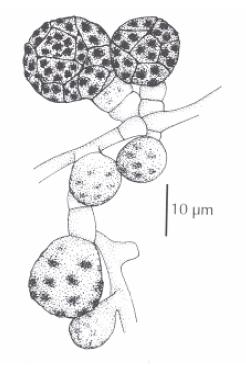 Epicoccum nigrum Epicoccum nigrum
