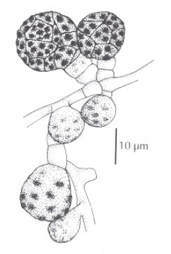 Epicoccum nigrum