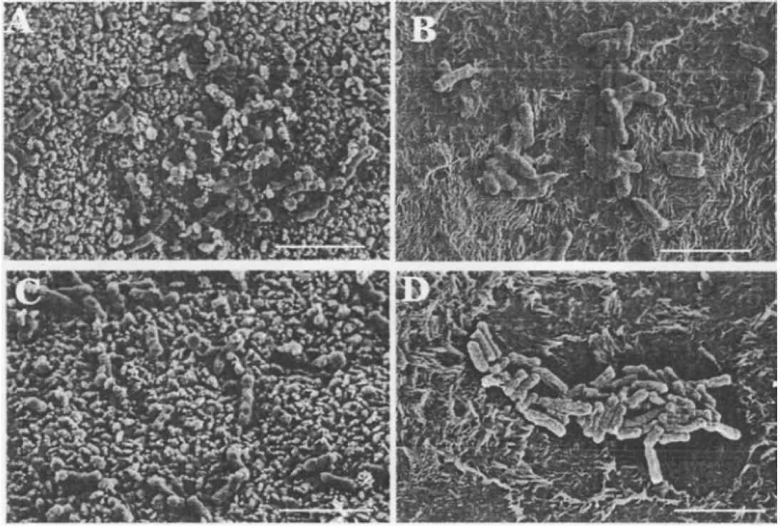 Observation au microscope électronique à balayage des cellules d’Escherichia coli fixées sur le cuivre (A, C) et le plastique (B et D) après 72 h de temps de contact à 4°C (A et B) et 20°C (C et D)