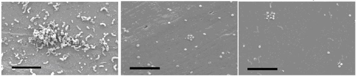 Observation au microscope électronique à balayage des cellules d’Helicobacter pylori fixées après 192 heures au cuivre (image du haut), au PVC (image du milieu) et au verre (image du bas) Observation au microscope électronique à balayage des cellules d’Helicobacter pylori fixées après 192 heures au cuivre (image du haut), au PVC (image du milieu) et au verre (image du bas)