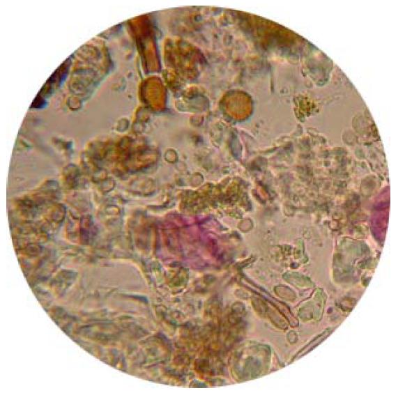 Spores sur membrane vaseline-toluène