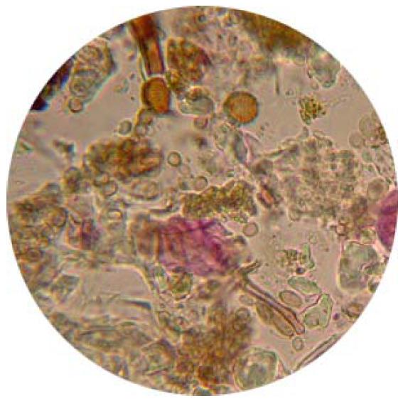 Spores sur membrane vaseline-toluène Spores sur membrane vaseline-toluène